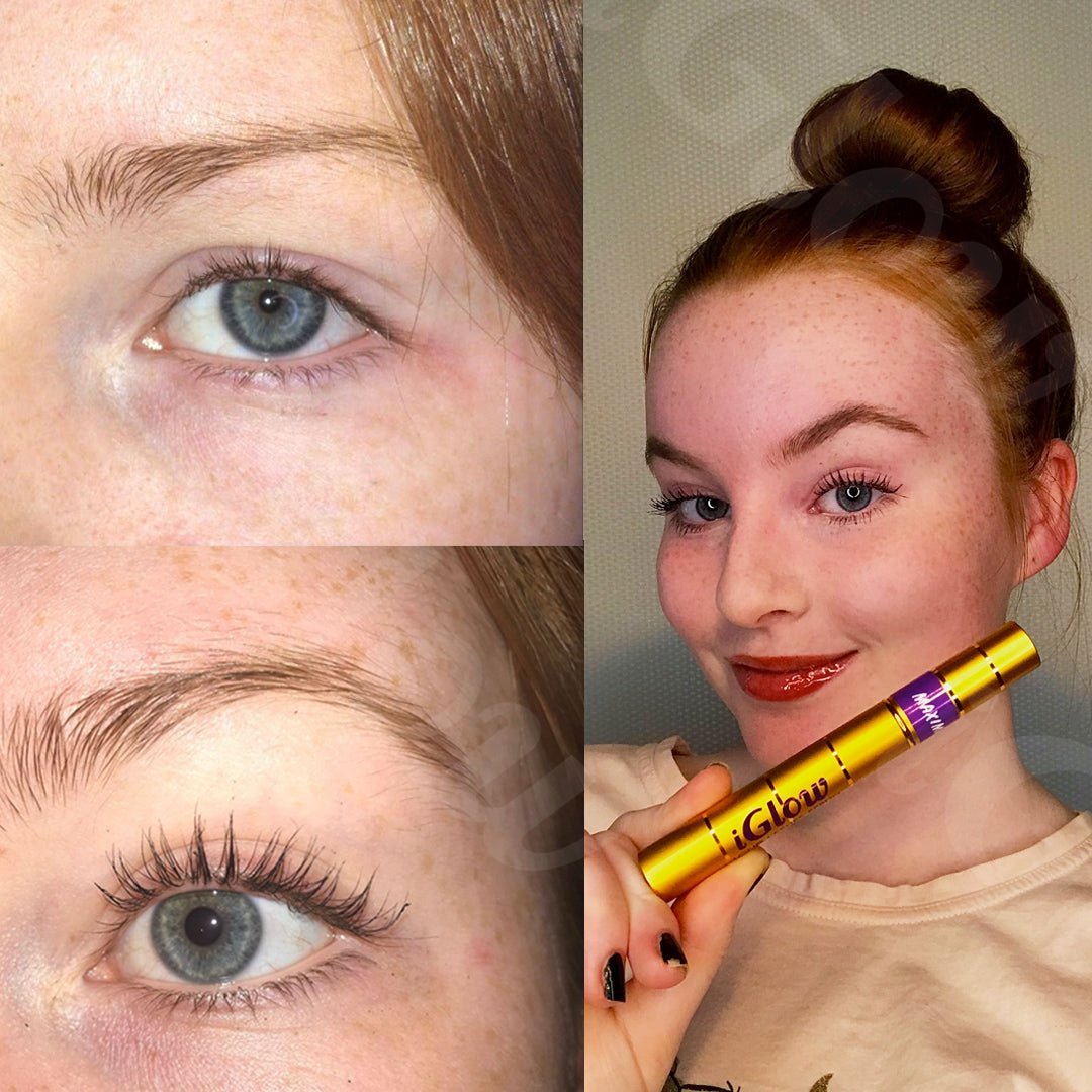 iGlow Lash &amp; Brow Maximizer + iGlow Under - eye Patches - iGlow Cosmetics